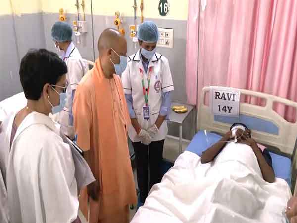 uttar-pradesh-cm-yogi-adityanath-meets-children-affected-by-food-poisoning-in-lucknow