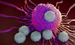 CAR T-cell therapy cuts cancer treatment cost by 90%